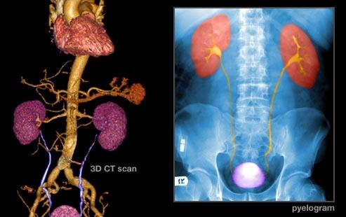 膀胱癌的诊断2：图像检测