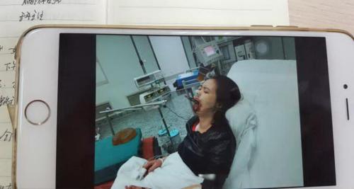 女子因喉嚨難受將30公分炒菜鍋鏟插進食道