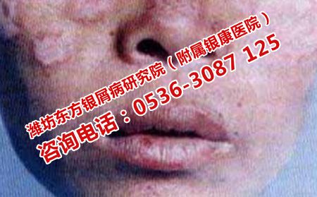 npx (16).jpg