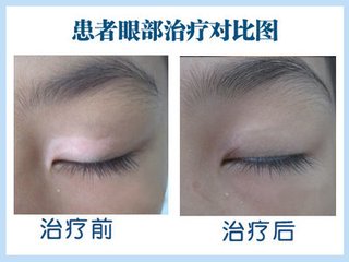 t0175fa8b55a3dabcd9.jpg眼部.jpg