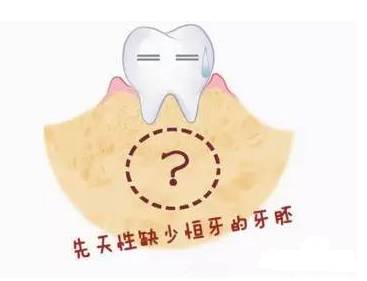 儿童一般从67岁开始换牙,但有些小朋友的牙总是迟迟不掉,恒牙