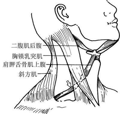 小儿肌性斜颈保守治疗