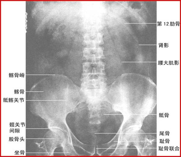 输尿管结石的分段