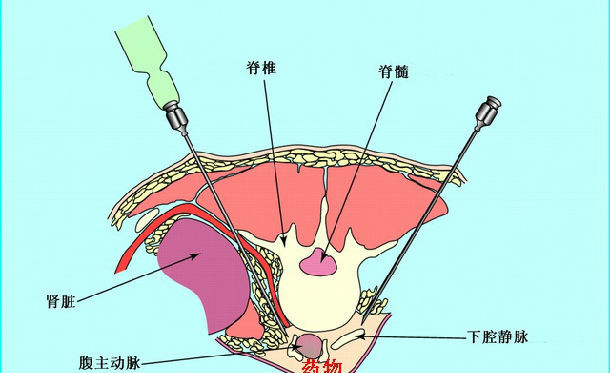 个人主页 医生文章 详情              1)定位不准确,患者不能明确