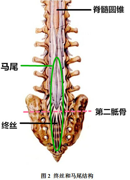 脊髓栓系综合征是怎么形成的?