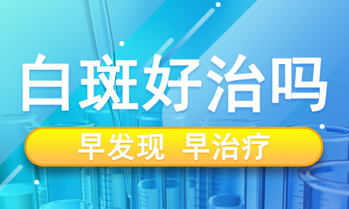 wpsF32B_tmp.png