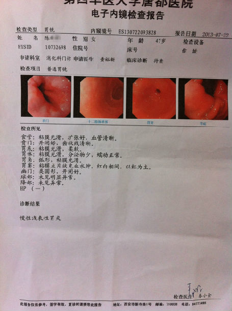 患者男性,70岁,慢性萎缩性胃炎病史30年.