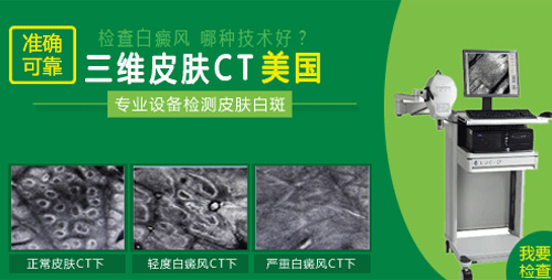 CT.gif