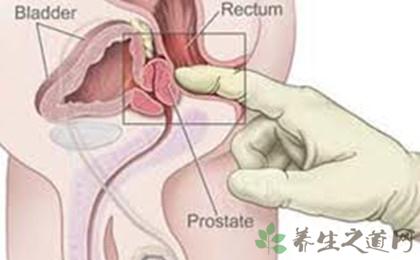 按摩前列腺有什么作用