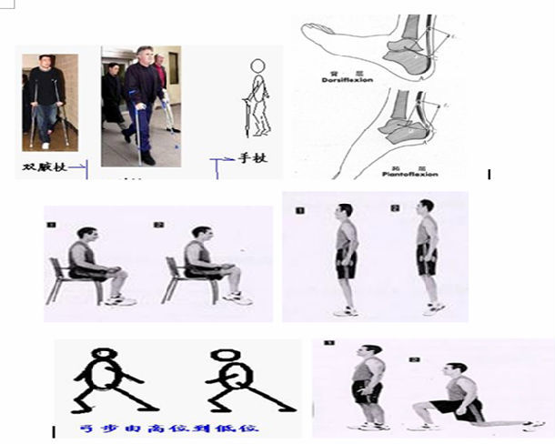 后期: 1.逐步丢拐,加大踝关节背伸和跖屈锻炼.