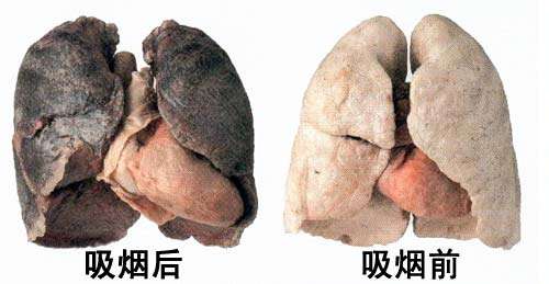 肿瘤医院史艳侠医生_肿瘤内科医生收入
