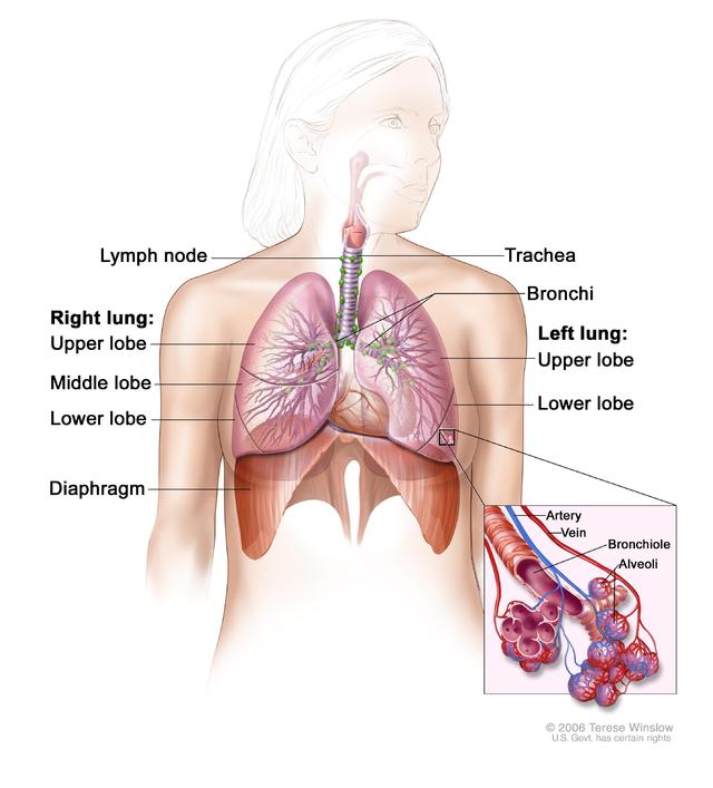 NSCLC 1.jpg