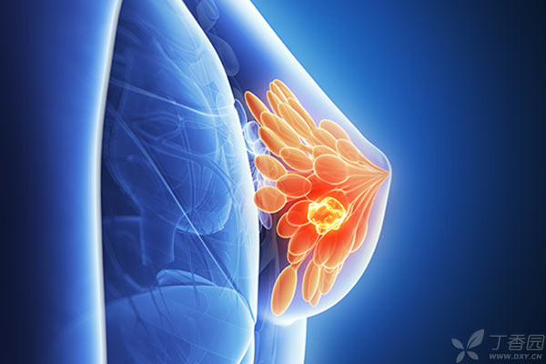 就目前的研究结果看,乳腺纤维瘤和乳腺癌并没有直接的关联,癌变的