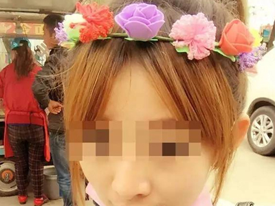 广东25岁女子因注射破尿酸致右眼失明 大面积脑梗死