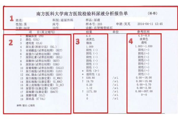 教你读懂尿常规报告中的" "号