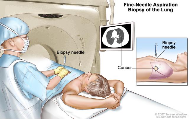 NSCLC 3.jpg