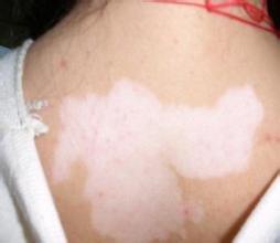 jpg u=3137697029,167036150&fm=21&gp=0.jpg