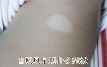 u=2282091451,1789467407&fm=21&gp=0.jpg