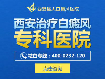 西安治疗白癜风专科医院.jpg