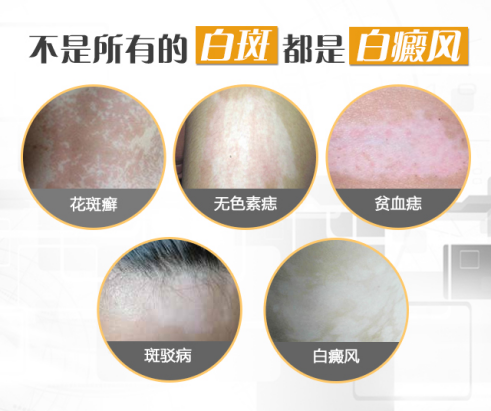 png 图片4.png
