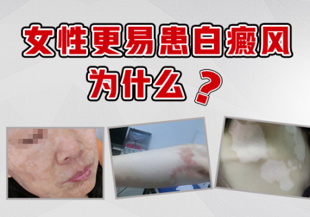 png 图片7.png