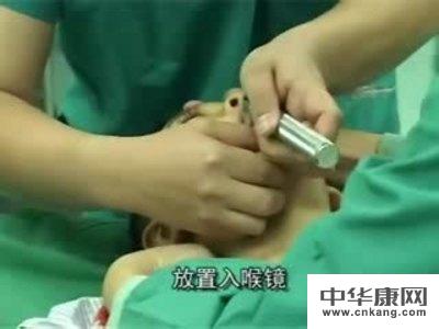 局部麻醉药中毒吃什么好?