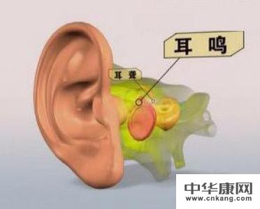 耳聋多年可以治愈吗