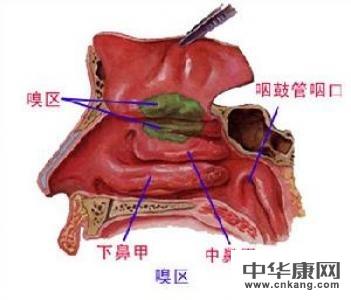 得了鼻窦炎有什么危害