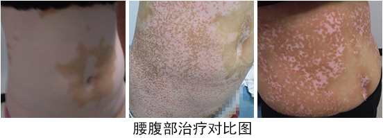 png 图片8.png