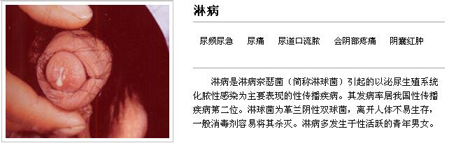 淋病.jpg