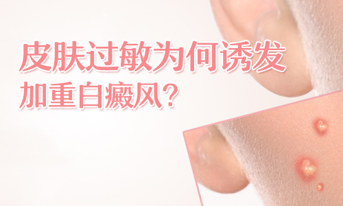 png 图片6.png