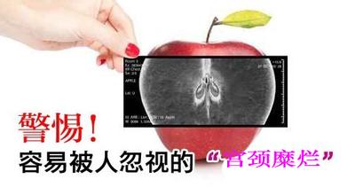 宫颈糜烂.jpg