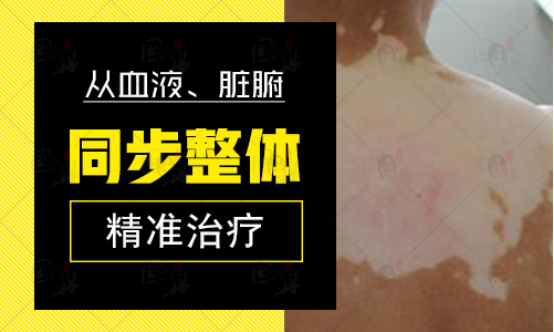 png wpsC18_tmp.png