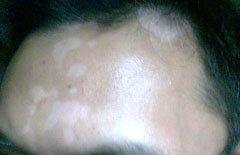 u=1585946585,3275148992&fm=21&gp=0.jpg