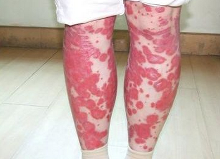 png QQ图片20170303155315.png