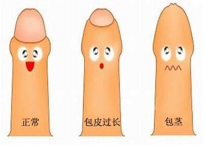 包皮.jpg