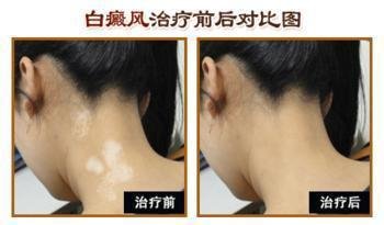 t0172a8c820492c1110.jpg女过程.jpg