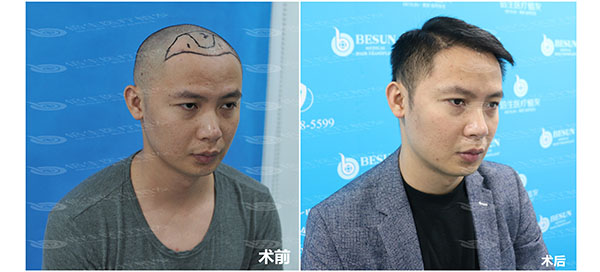 jpg _0000_罗腾对比.jpg