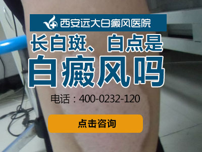 长白斑、白点是白癜风吗？.jpg