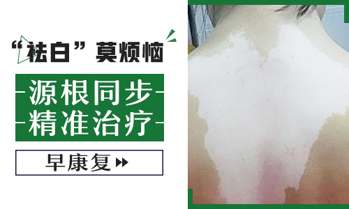 png 图片1.png