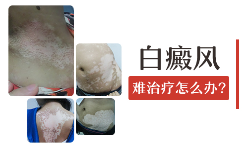 png 图片2.png