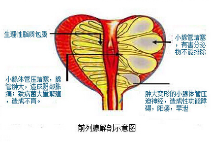 前列腺解剖示意图.jpg