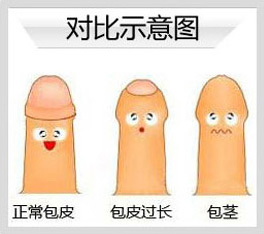 包皮.jpg