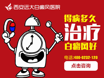 得病多久治疗白癜风好.jpg