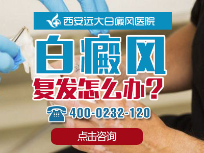 白癜风复发怎么办？.jpg