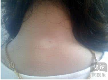 u=2471063178,1064692549&fm=26&gp=0.jpg