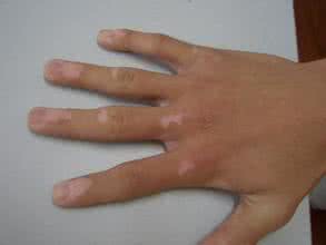 u=940318876,2084422144&fm=26&gp=0.jpg