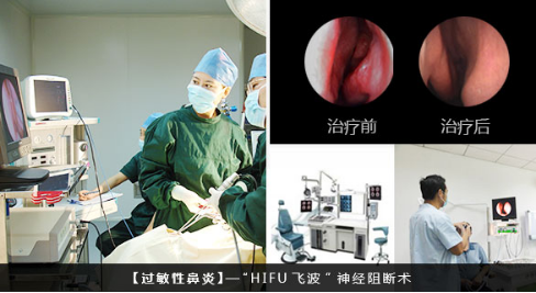 png b过敏性鼻炎的治疗方法.png