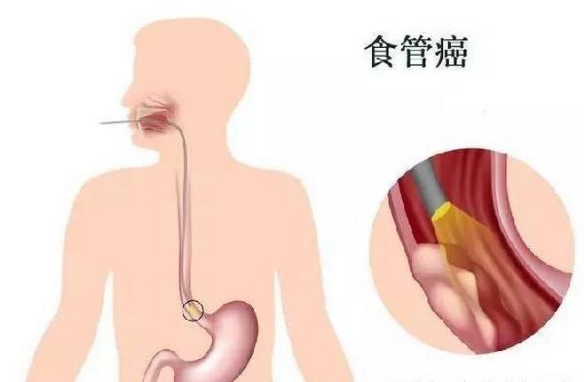 ʳɹж