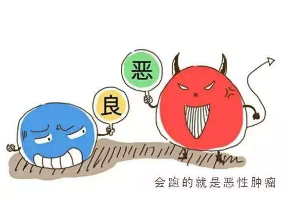 良性肿瘤与恶性肿瘤的四大区别